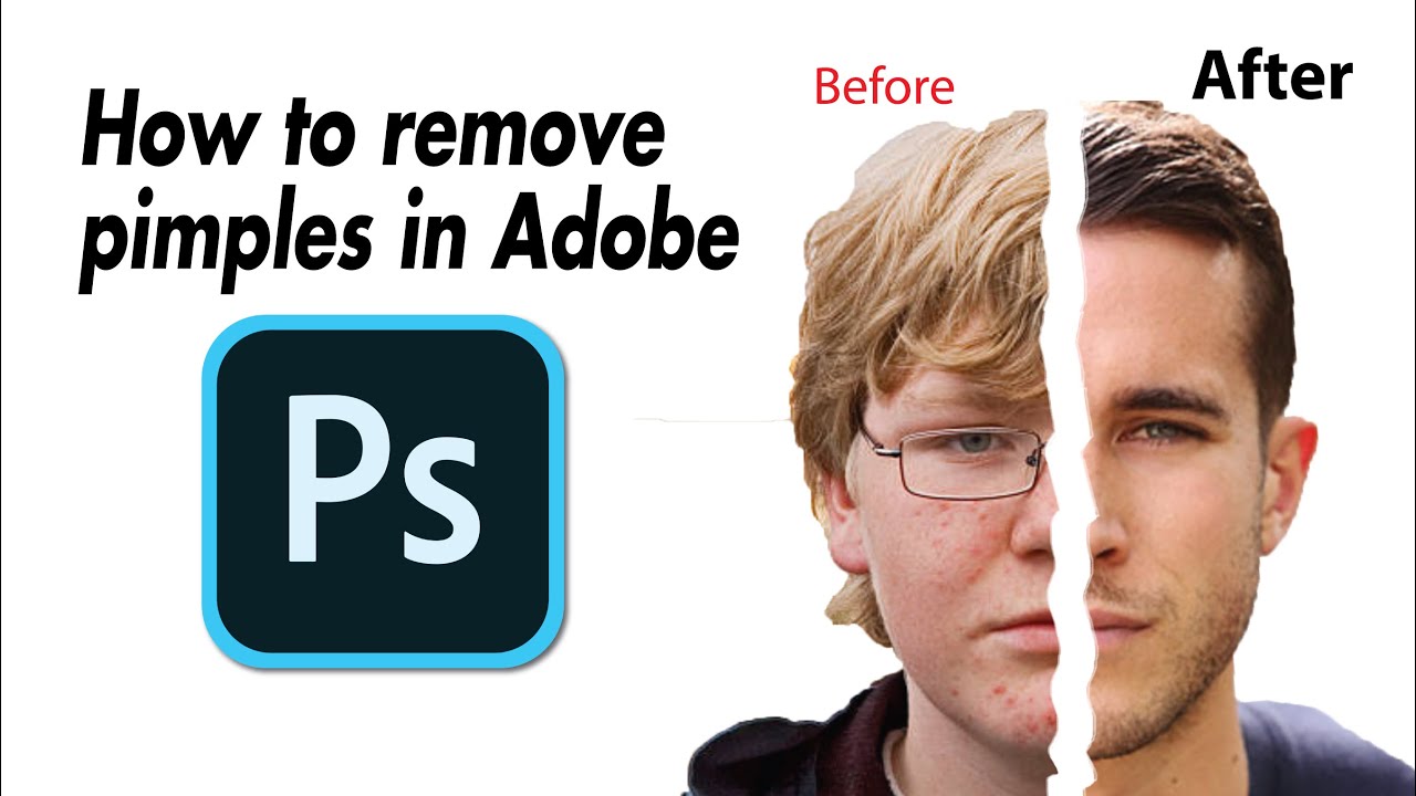 How to remove pimples and blemishes in Adobe Photoshop.