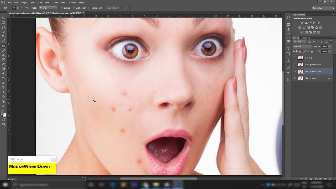 How To Remove face Pimples in Photoshop || Photoshop Kannada Tutorial